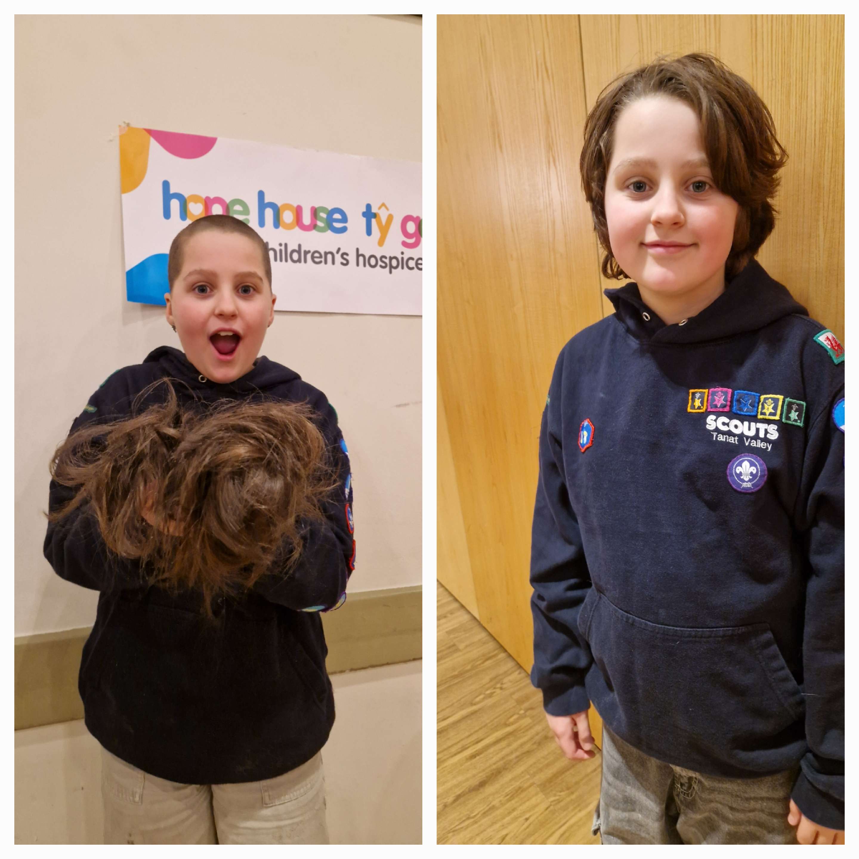 Emily's Sponored Head Shave