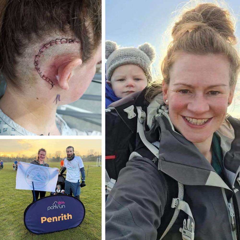 Raising money for The Beyond Recovery Project and to raise awareness of Acoustic Neuroma brain tumours