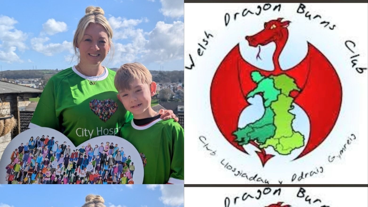 Don't wait until you need them -  Help them today! Running the Cardiff Half 2026 for City Hospice & Welsh Dragons Burns Club