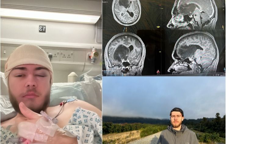 George running 310km in 180 days for charity